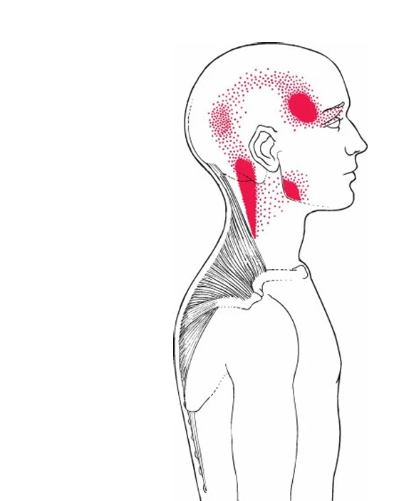 A side view of a person's head

AI-generated content may be incorrect.