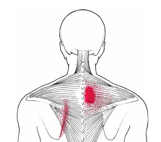 A back view of a person's back

AI-generated content may be incorrect.